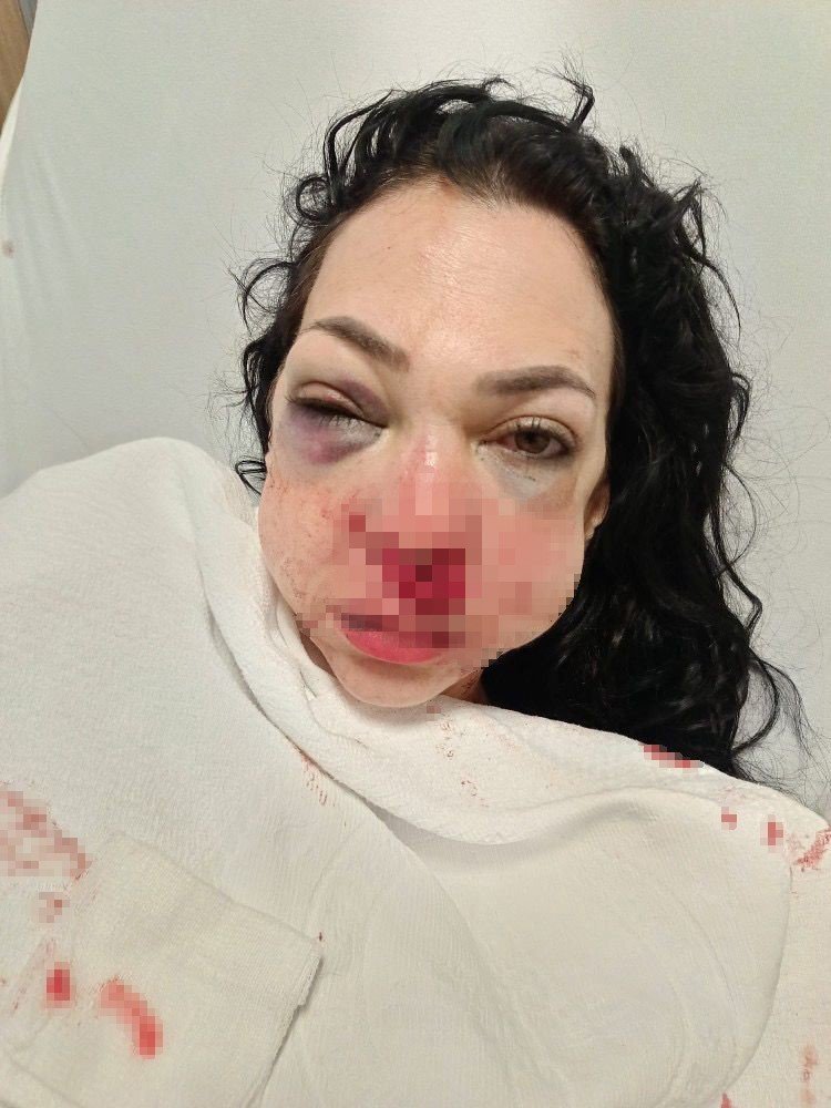 Kafasında 60 dikiş, yüzünde kırılmamış kemik kalmamıştı! Anne oğula öldüresiye darpta ilk duruşma: Adli Tıp’tan yeni rapor istenecek
