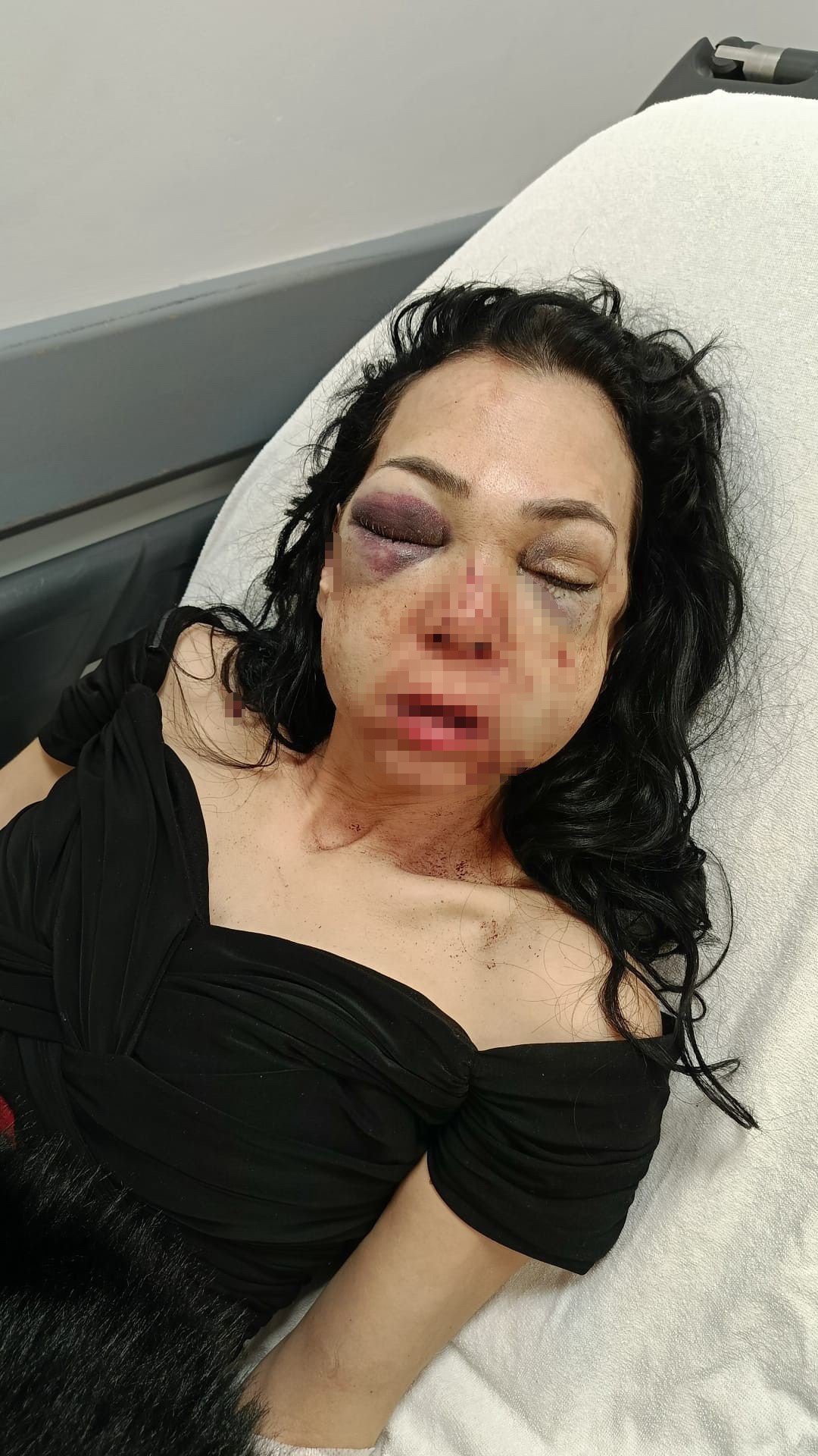 Kafasında 60 dikiş, yüzünde kırılmamış kemik kalmamıştı! Anne oğula öldüresiye darpta ilk duruşma: Adli Tıp’tan yeni rapor istenecek