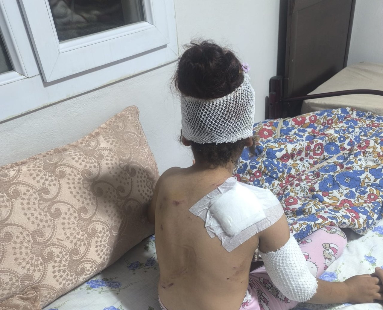 8 köpek birden saldırdı! Şanlıurfa'da dehşet: Çocuğa 150 dikiş atıldı
