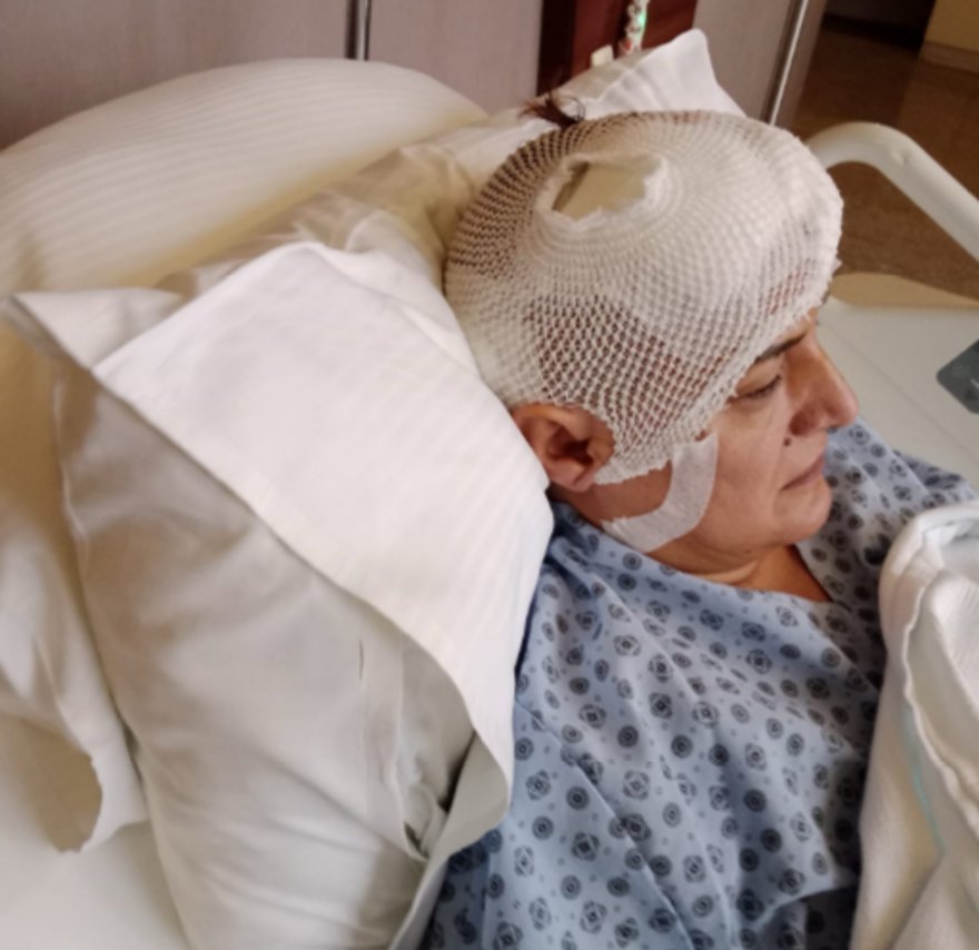 Dişini çektirmek için kliniğe gitti, hayatı kabusa döndü! İmplant sonrası beyin ameliyatı geçirdi