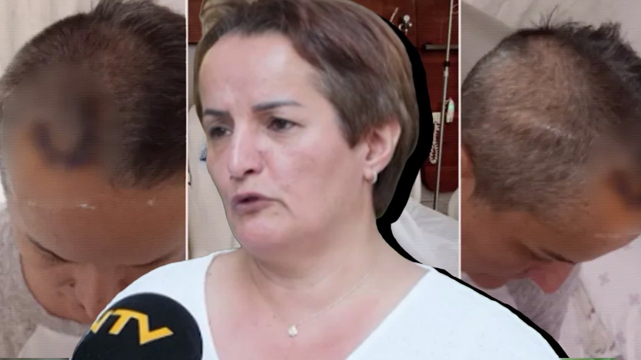 İMPLANT HAYATINI ALTÜST ETTİ
