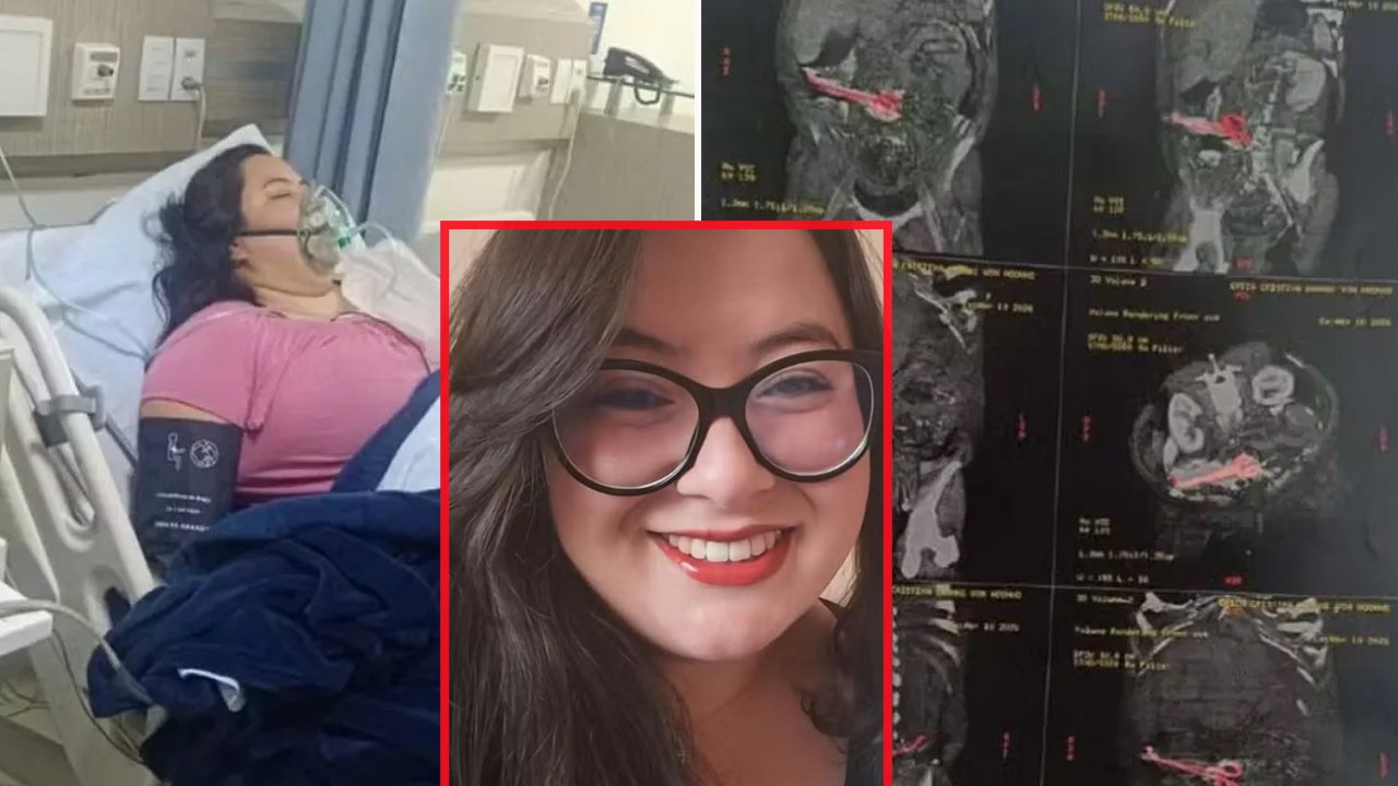 Aylardır ciddi karın ağrısı çekiyordu! Acının nedeni ameliyatta ortaya çıktı
