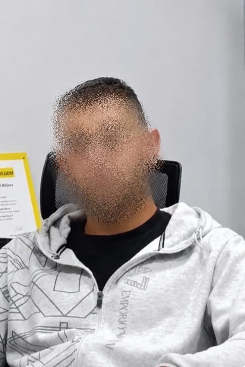 Ankara’da korkunç olay!  İmdat sesini duydu, kabusu yaşadı: Kız çocuklarını kurtaran 72 yaşındaki adam dakikalarca darp edildi