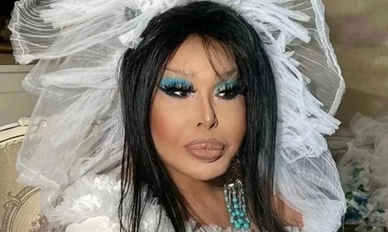 Bülent Ersoya estetik operasyon! İlk açıklama hastane odasından geldi