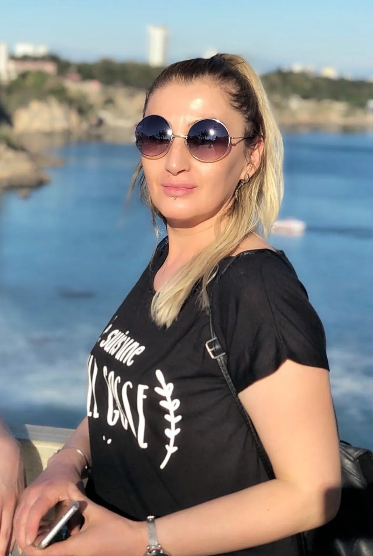 Dudağı tamamen çürüdü! Antalya’da özel estetik merkezinde skandal: Tavsiyeyle gitti hayatı karardı