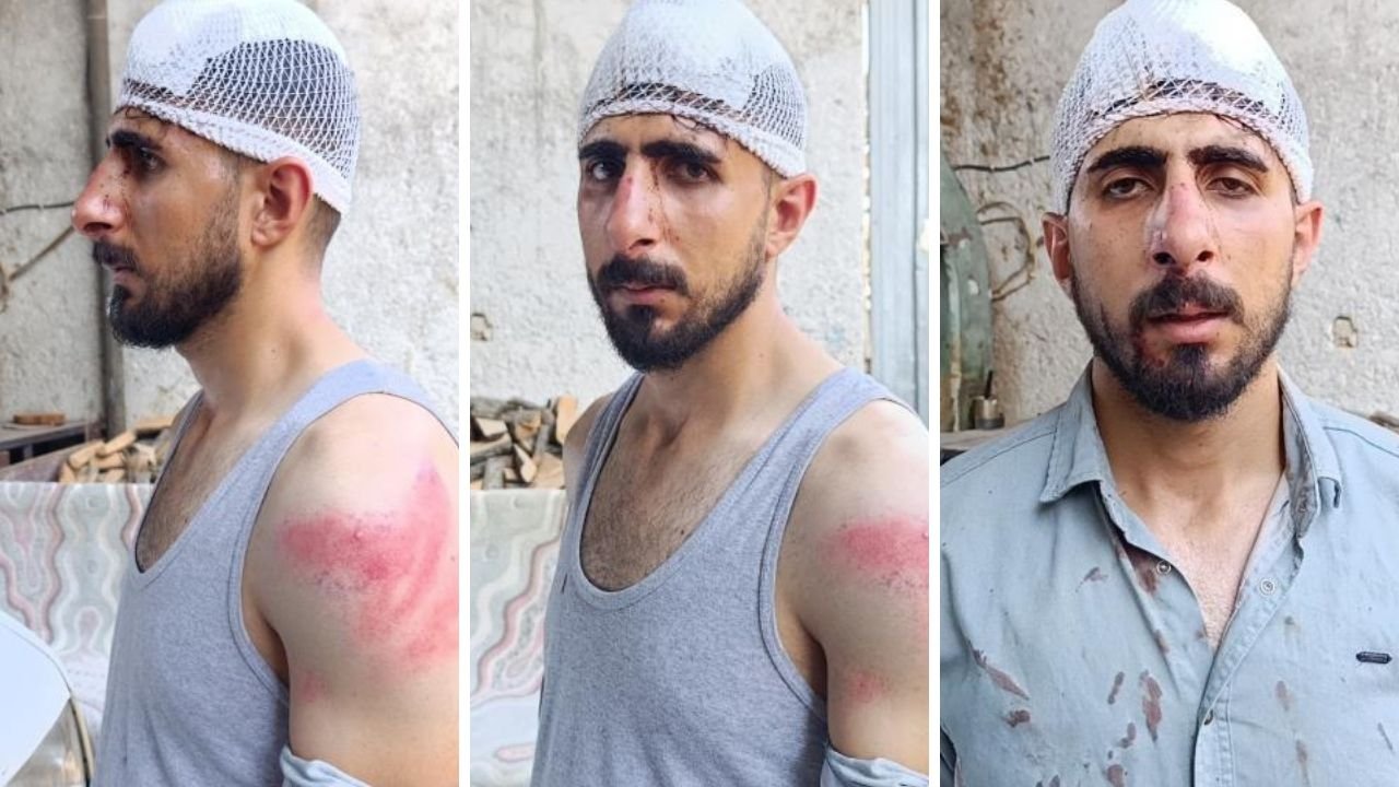 Tek suçu trafikte yavaş gitmek! Burnu kırıldı, başına 8 dikiş atıldı