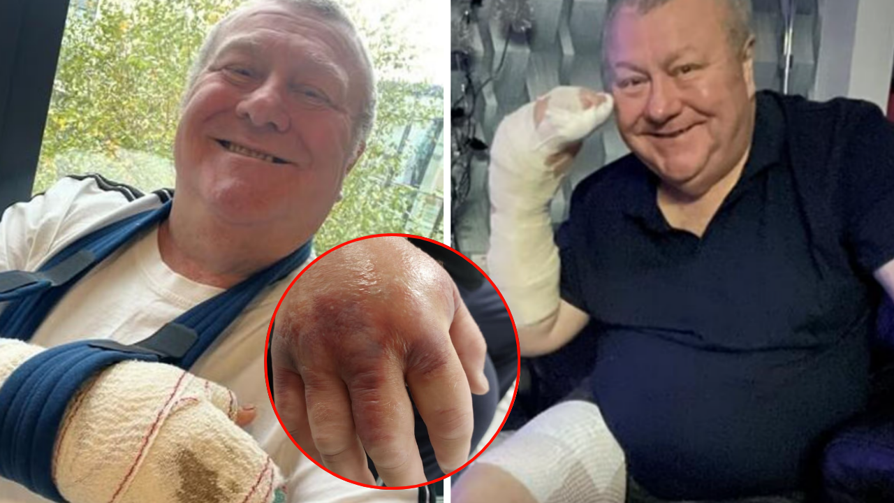Dokunduğu örümcek kabusu oldu! Elinden tüm vücuduna yayıldı: Konuşma yetisini kaybetti, komaya girdi