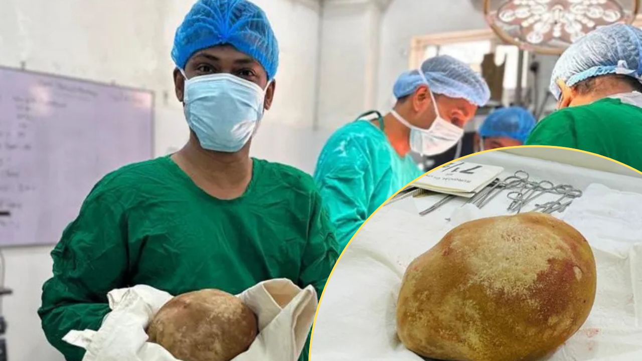 Mesanesinden çıkan 3 kiloluk taş doktorları bile şaşkına çevirdi: Böylesi hiç görülmedi 