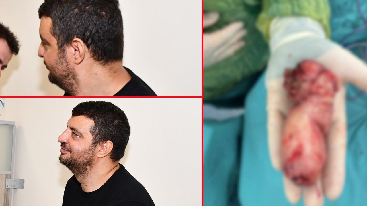 Yutma güçlüğü çekiyordu, yemek yiyemiyordu! Gerçek hastanede ortaya çıktı