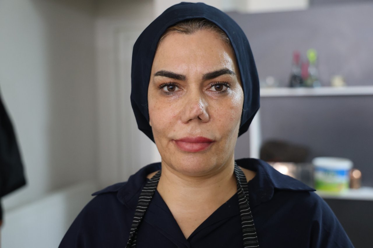 Aynaya bakamaz hale geldi! Burnunun bir ucu farklı, diğer ucu farklı… 2 çocuk annesinin hayatı ameliyatla kabusa döndü