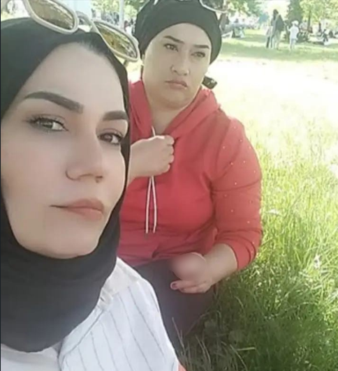 Aynaya bakamaz hale geldi! Burnunun bir ucu farklı, diğer ucu farklı… 2 çocuk annesinin hayatı ameliyatla kabusa döndü