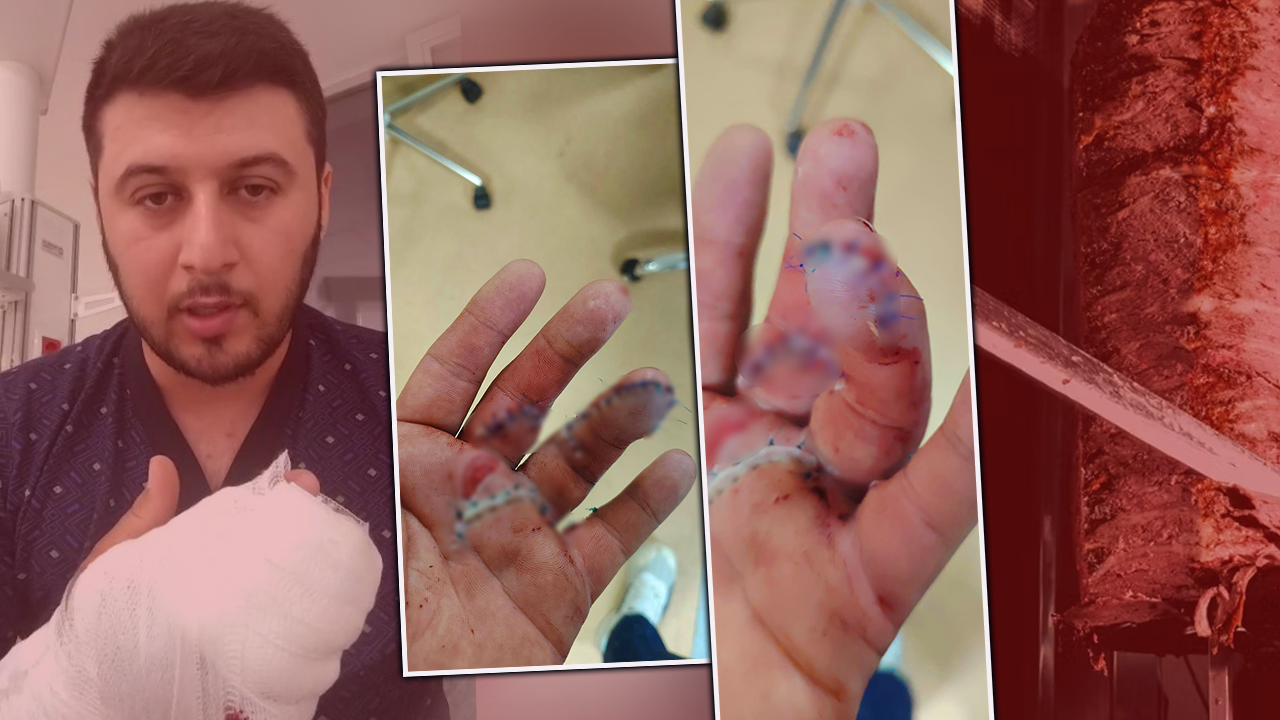 2 parmağı ikiye bölündü! Motokuryeye dehşeti yaşattı: Döner bıçağıyla saldırdı, bıçak kırıldı durmadı 