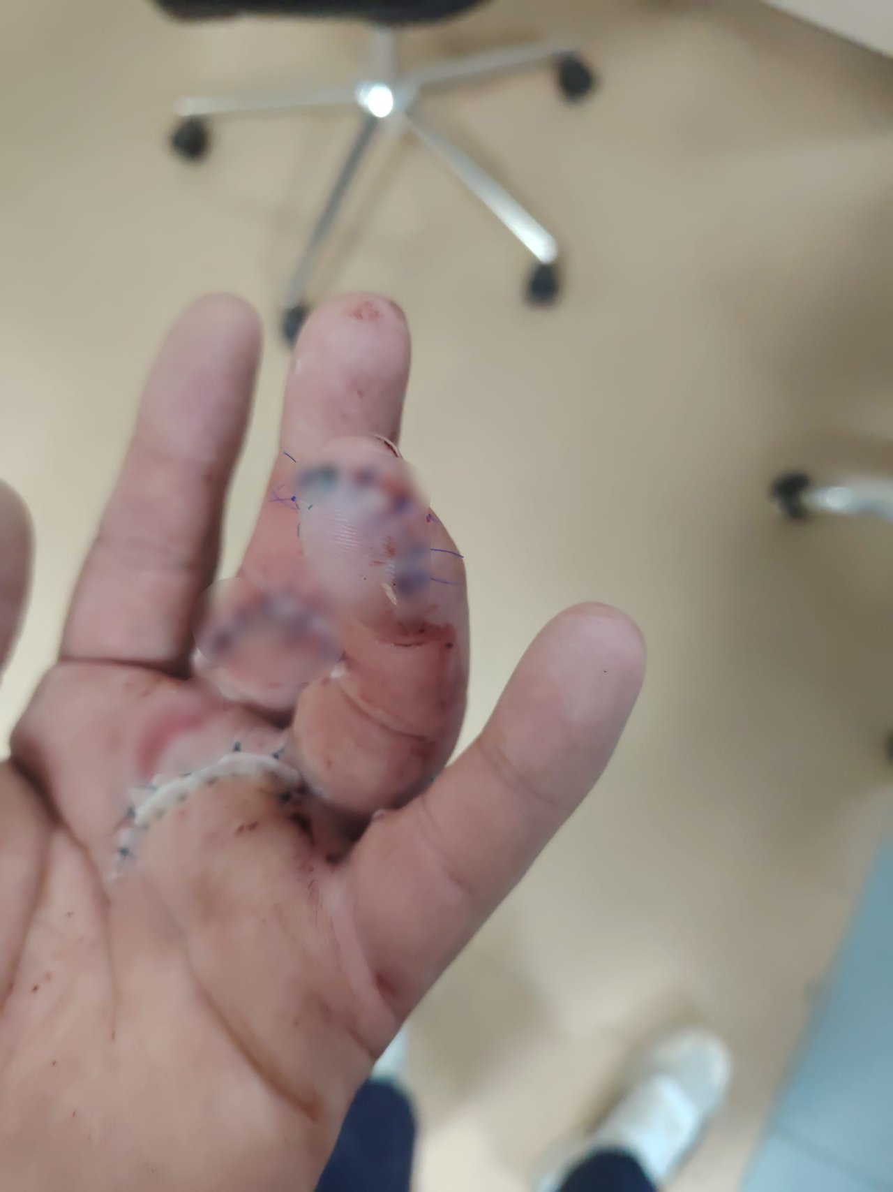 2 parmağı ikiye bölündü! Motokuryeye dehşeti yaşattı: Döner bıçağıyla saldırdı, bıçak kırıldı durmadı
