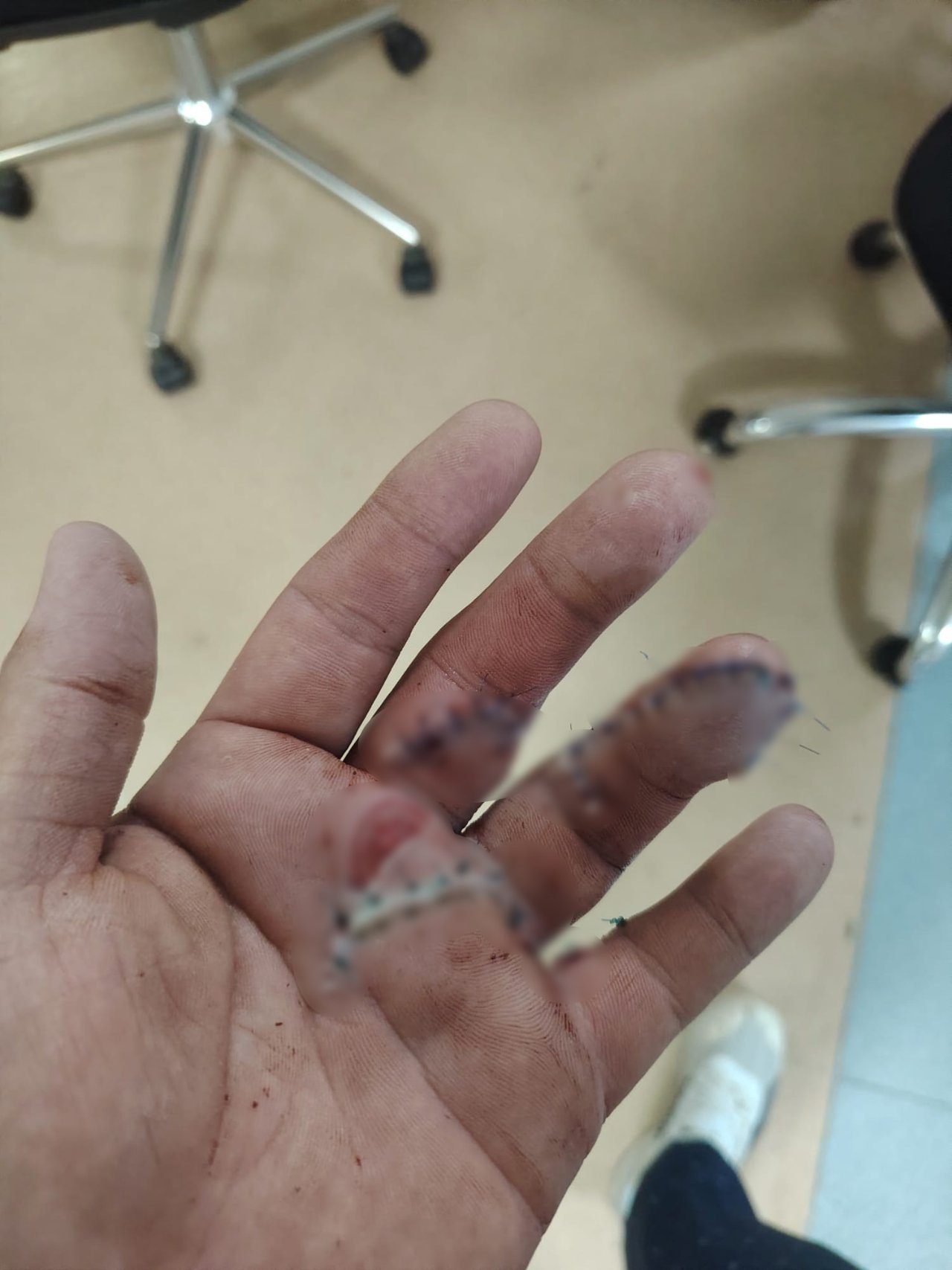 2 parmağı ikiye bölündü! Motokuryeye dehşeti yaşattı: Döner bıçağıyla saldırdı, bıçak kırıldı durmadı
