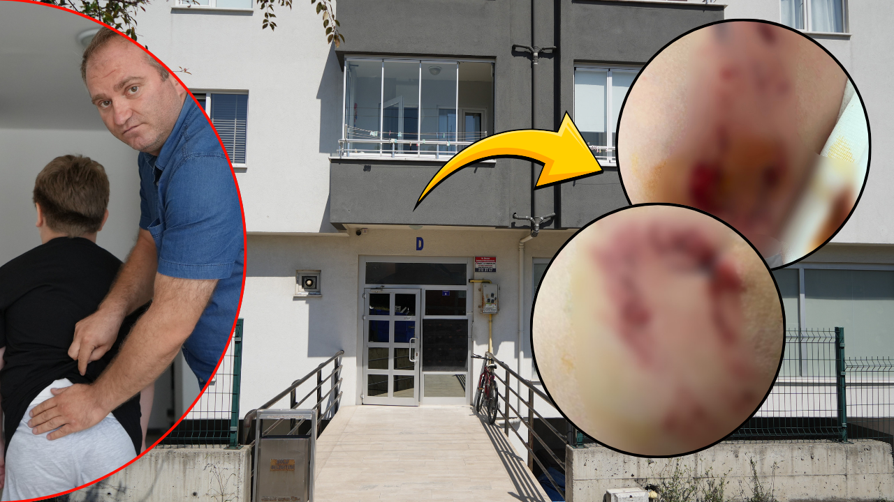Belçika kurdu dehşet saçtı! Çocuğu arkadan kaptı, kalçasını ısırdı: Sahibinden pes dedirten savunma