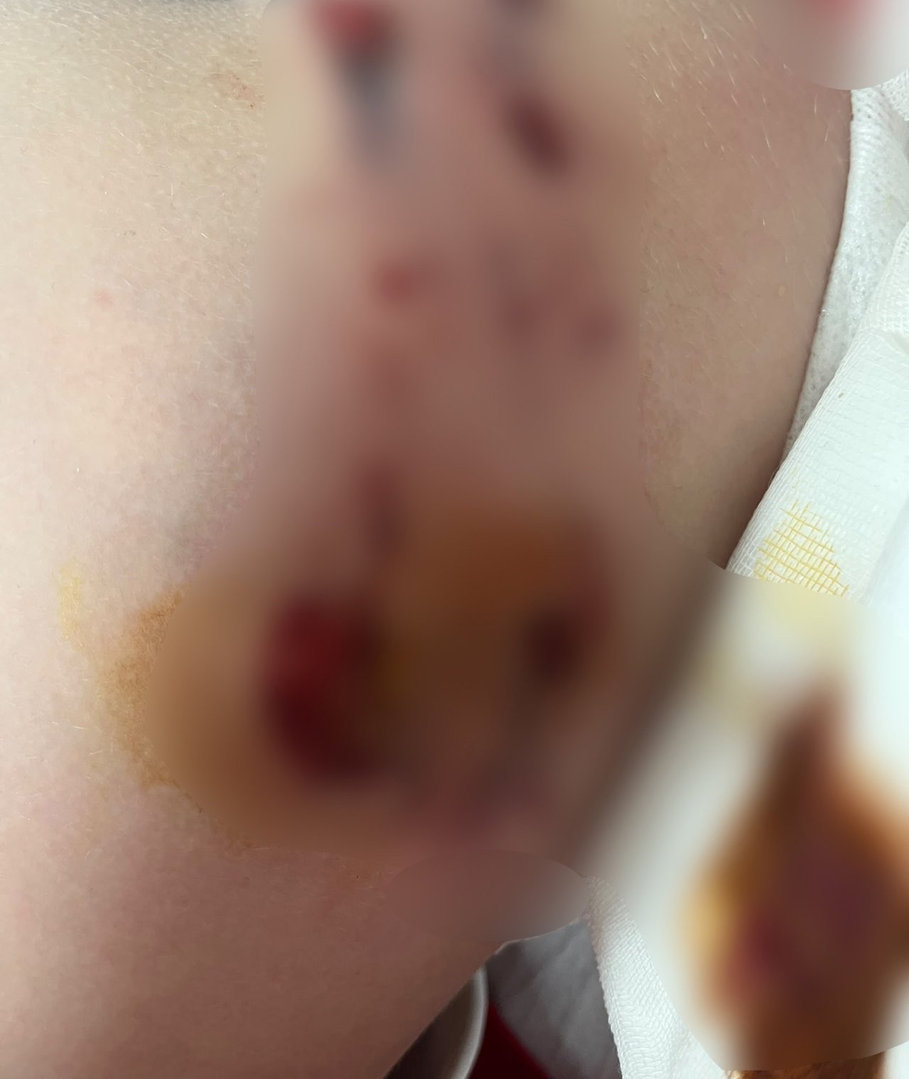 Belçika kurdu çocuğun kalçasını ısırdı! Sahibinden akıllara durgunluk veren savunma gibi başlıklar