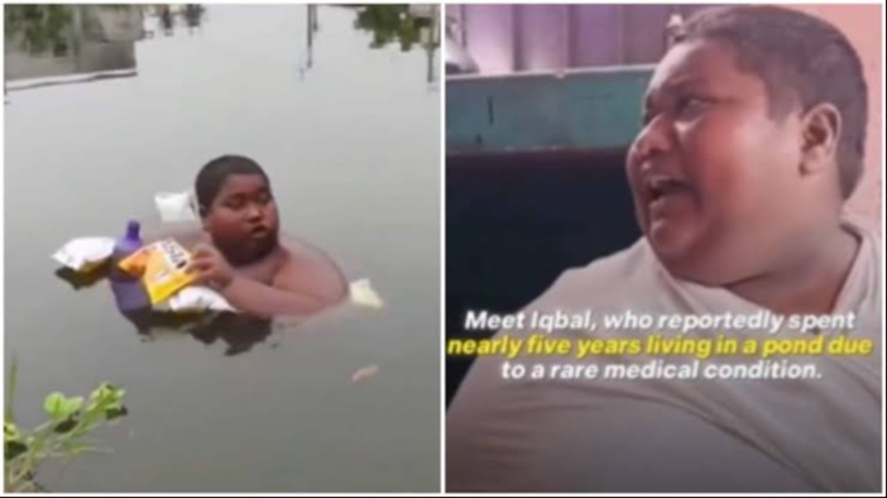 5 yıldır göletten bir an bile çıkamıyor! Sudan çıktığı an cildi alev alıyor: Nadir görülen hastalık tıp dünyasını şoke etti
