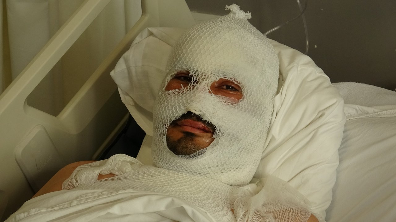 Felaketin ortasında büyük fedakarlık! Kolları, yüzü, ayakları… Vücudu sargı bezleriyle kaplı