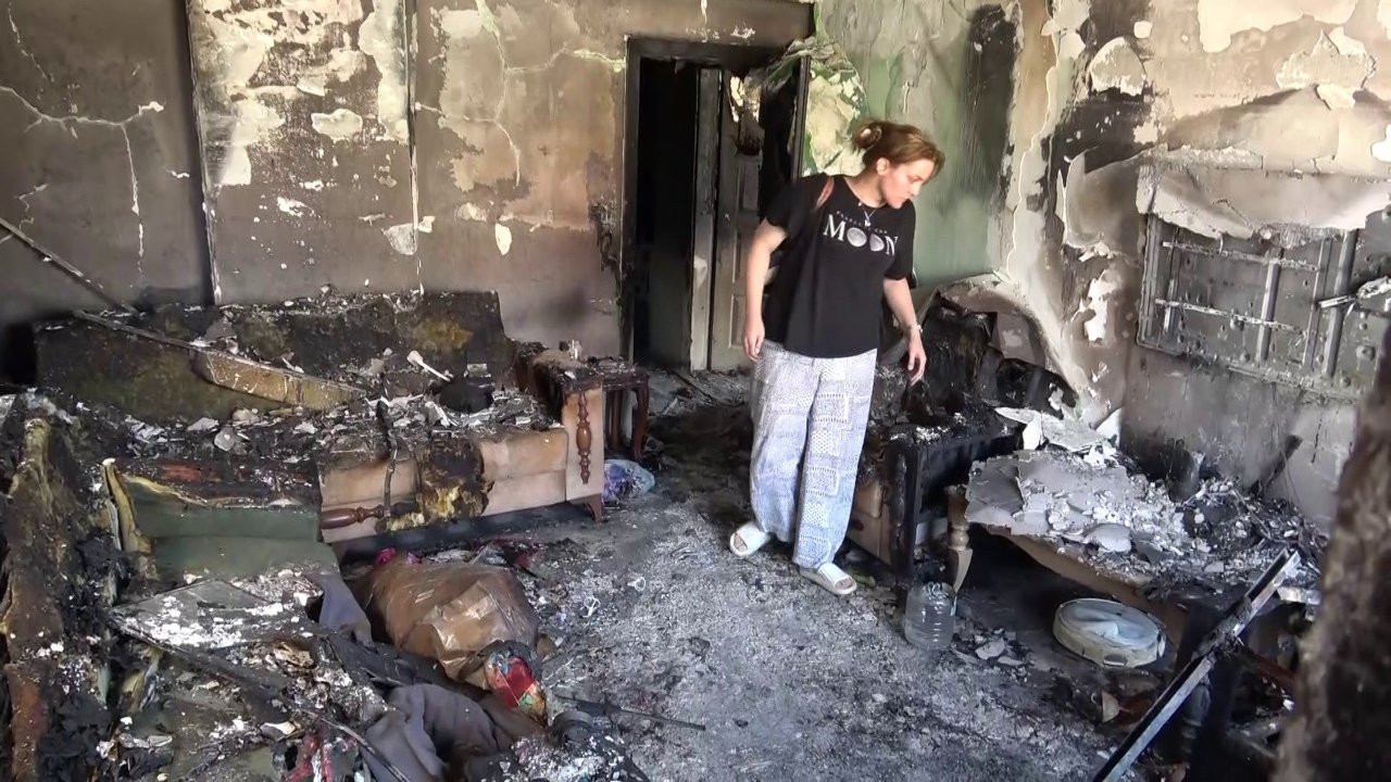 Felaketin ortasında büyük fedakarlık! Kolları, yüzü, ayakları… Vücudu sargı bezleriyle kaplı