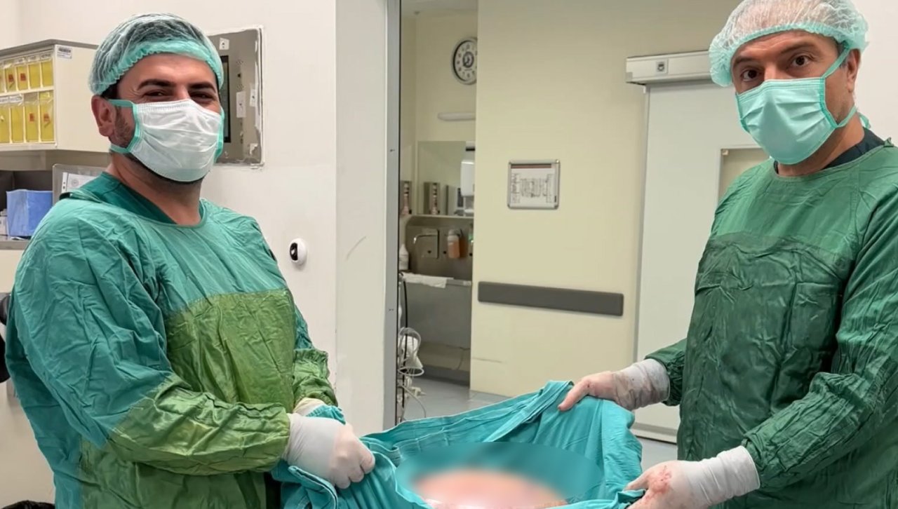 Görenler hamile sanıyordu! Gerçek ameliyatta ortaya çıktı