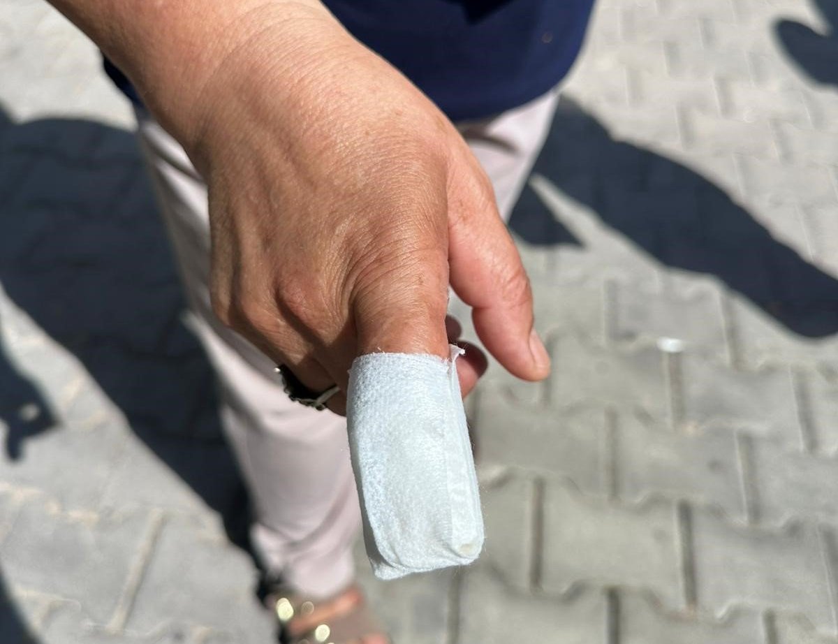 Sokak ortasında pitbull dehşeti! 5 çocuk annesi kadının parmağı koptu