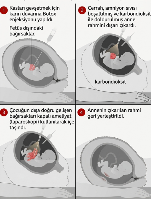 Kaynak: BBC