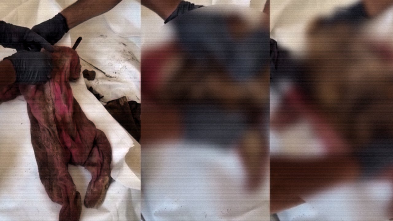 Gazze’de insanlığın bittiği an: Enkazdan bebeğin tulumu içinde sadece kemikleri çıktı!