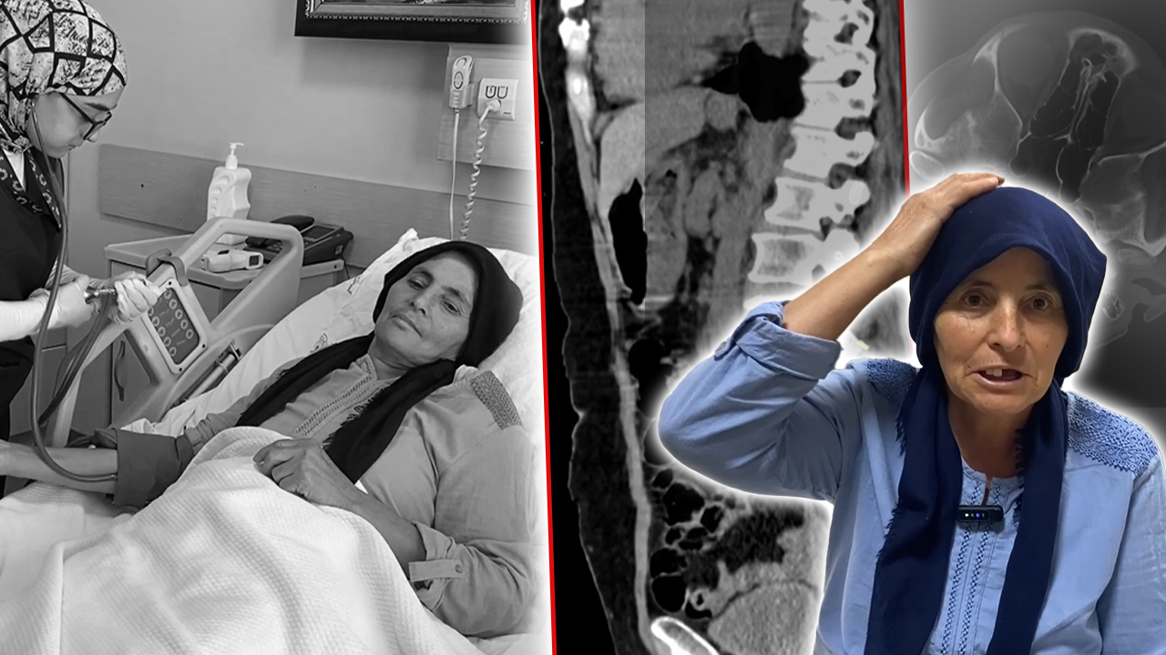 Ne kitle ne bebek… 8 ay karnında kafatası kemiğini taşıdı! 3 çocuk annesinin sıradışı hikayesi 