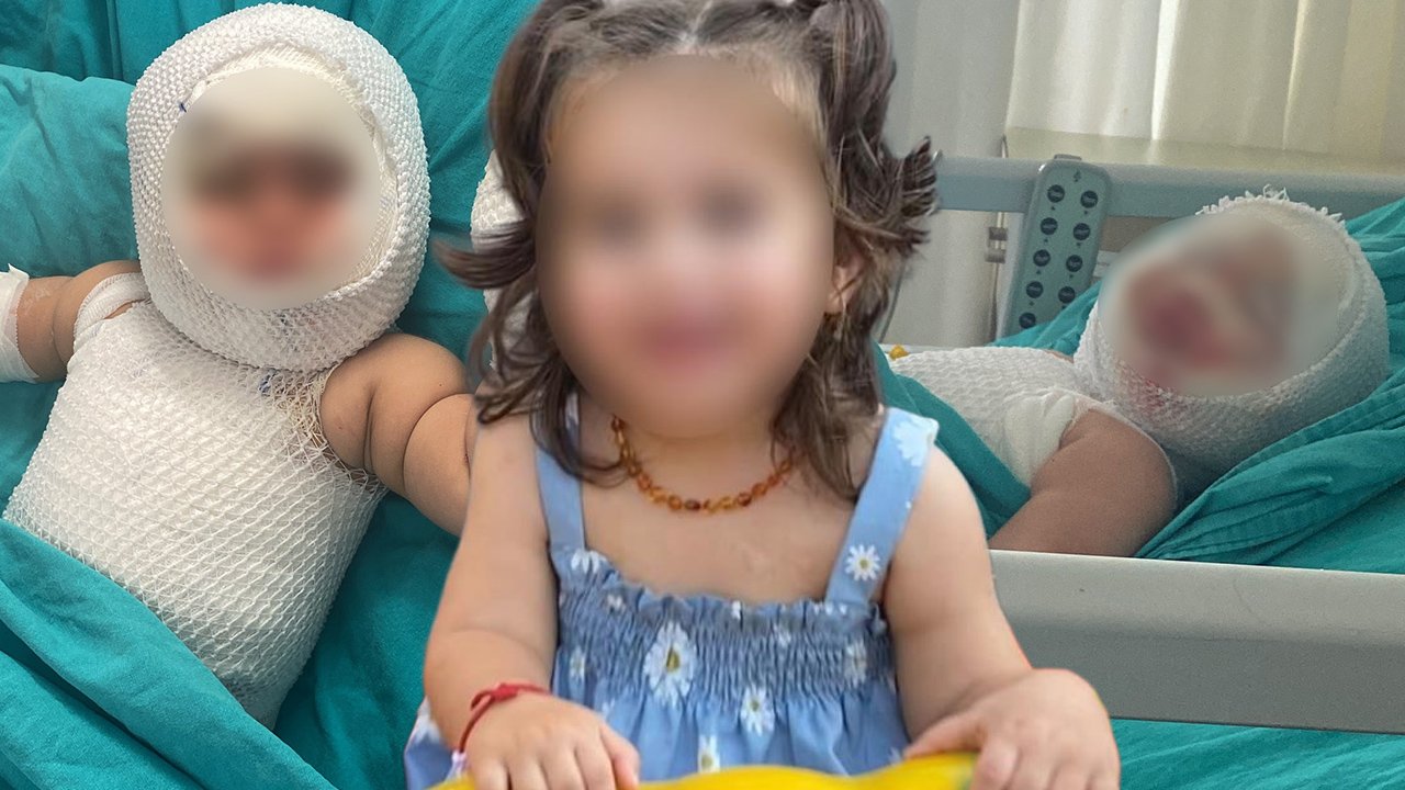 Eliz'in hayatı bir anda kabusa döndü! Patlayan konserve ağır yaraladı