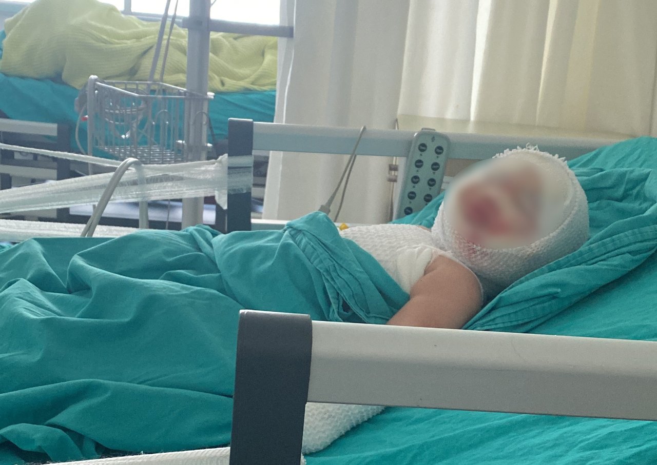 Elizin hayatı bir anda kabusa döndü! Patlayan konserve ağır yaraladı
