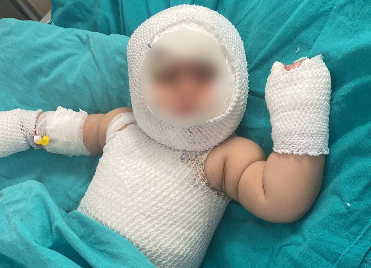 Elizin hayatı bir anda kabusa döndü! Patlayan konserve ağır yaraladı