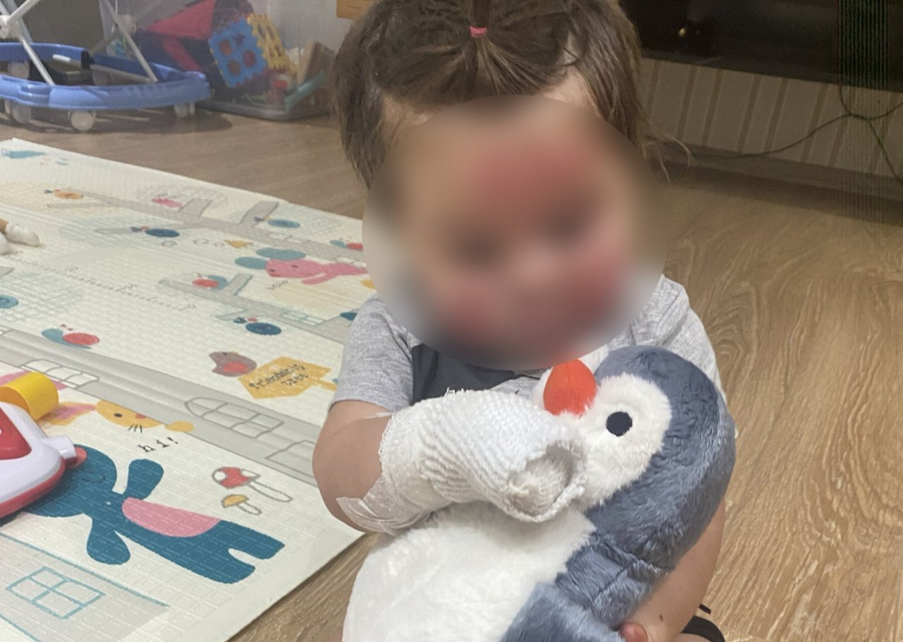 Elizin hayatı bir anda kabusa döndü! Patlayan konserve ağır yaraladı