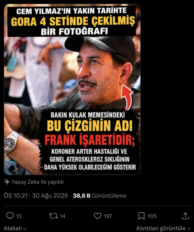 Kulak memesindeki frank çizgisi nedir, kalp krizi belirtisi mi?