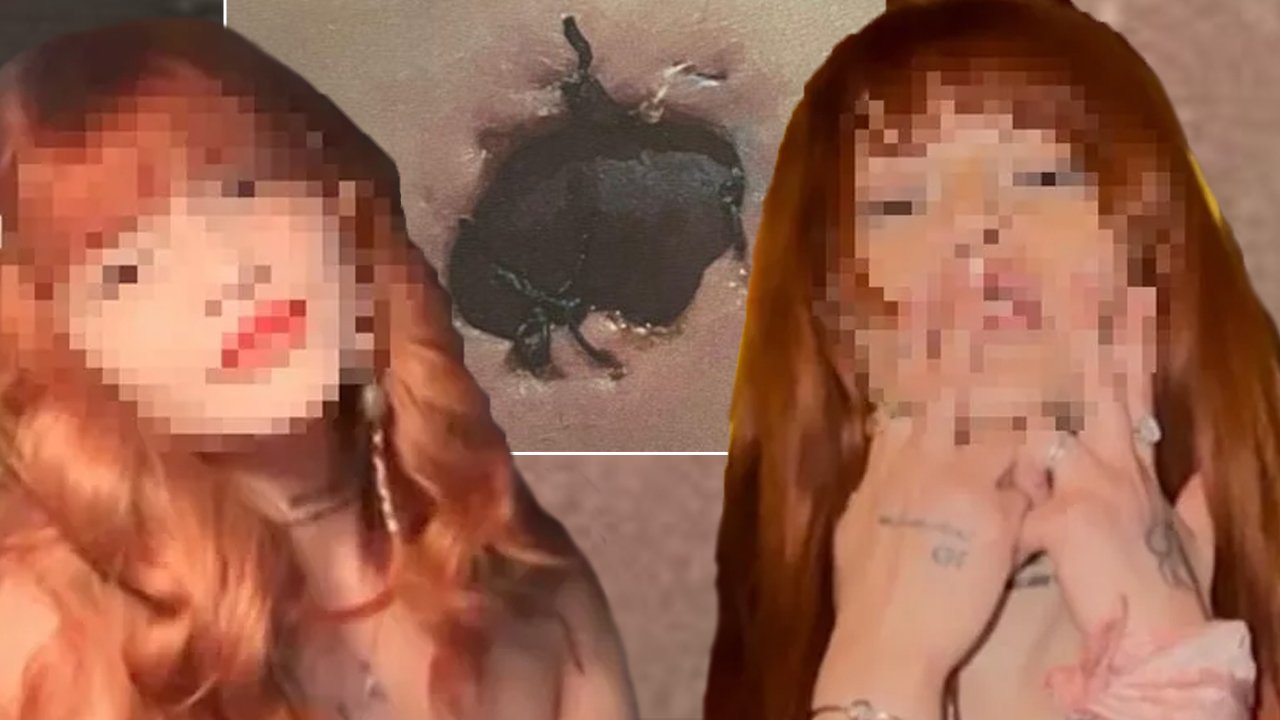 Profesyonel dansçının estetik ameliyatı hayatını mahvetti