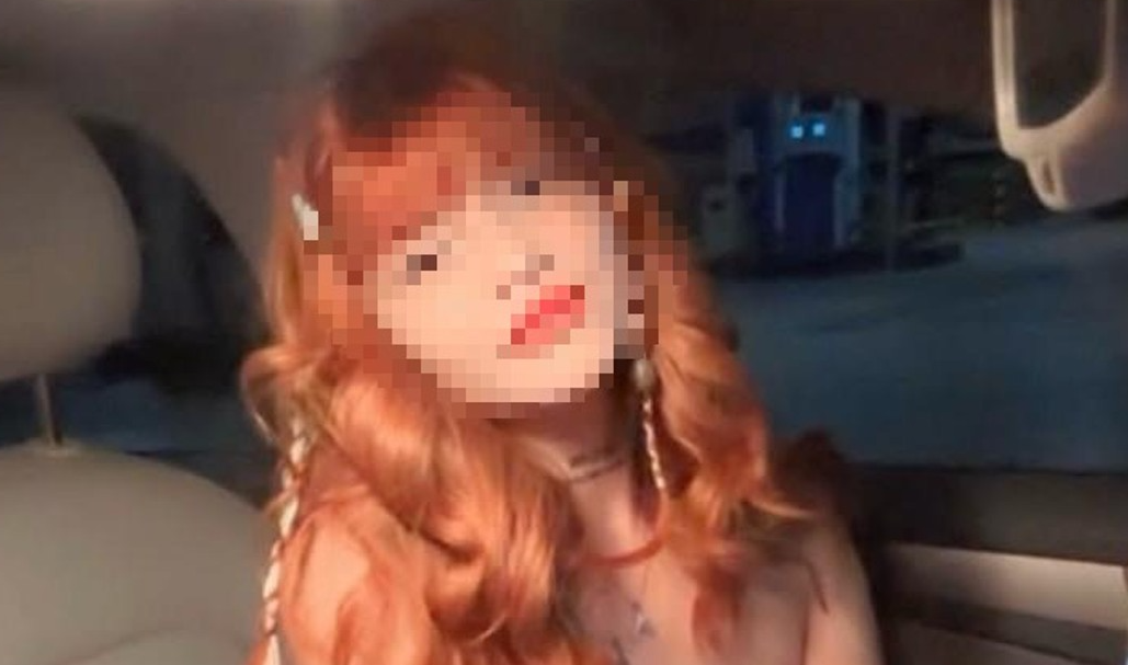 Profesyonel dansçının estetik ameliyatı hayatını mahvetti