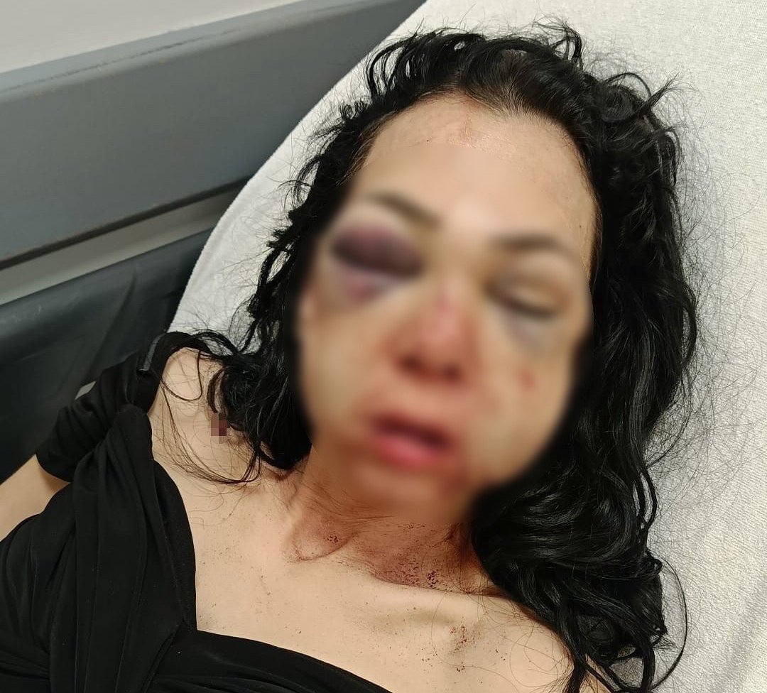 Anne-oğula bardak ve kül tablasıyla dehşeti yaşatmıştı: Kafedeki kanlı saldırıda flaş gelişme