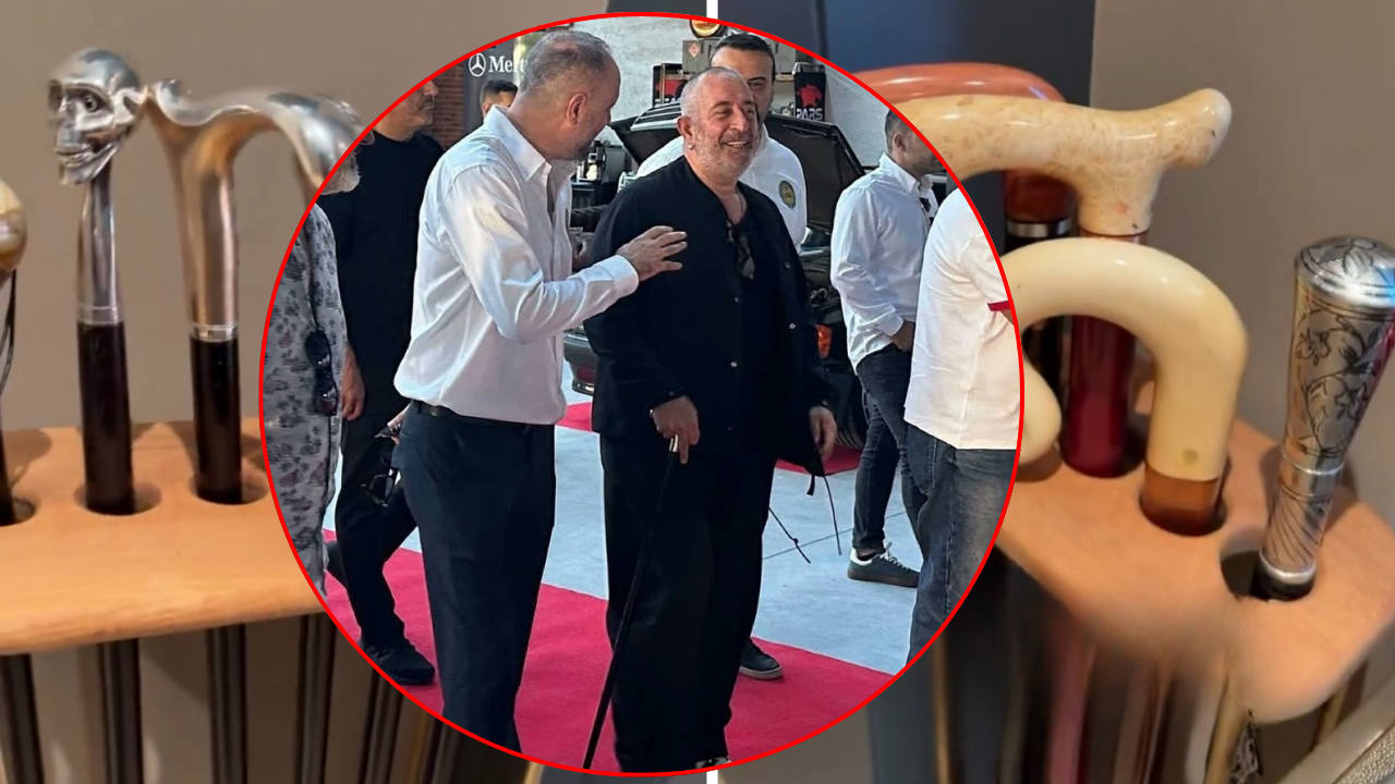 Bastonlu hali çok konuşuldu! Cem Yılmaz'dan gündem olan görüntülere şaşırtan cevap