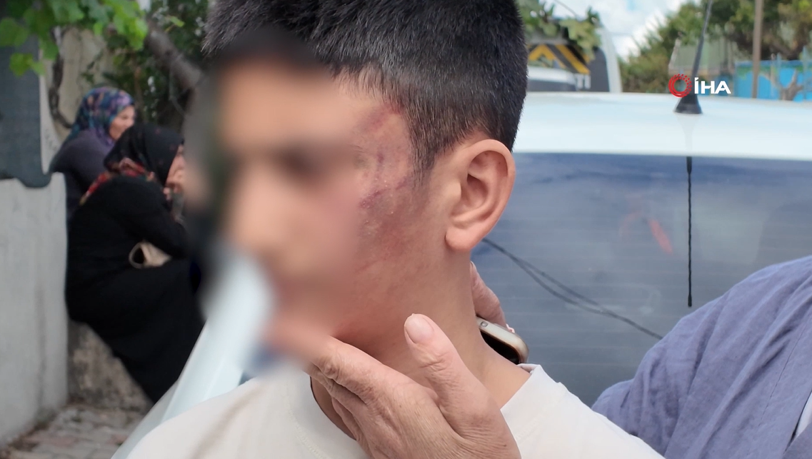 Arnavutköyde kan donduran akran zorbalığı! 12 yaşındaki epilepsi hastası çocuğu dakikalarca darp ettiler