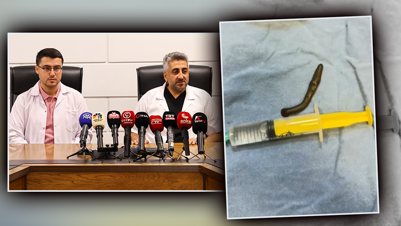 Boğazından canlı sülük çıkmıştı! Herkesin konuştuğu öğretmen konuştu: Yara sanıyordum, çoğalırsa diye panik oldum 