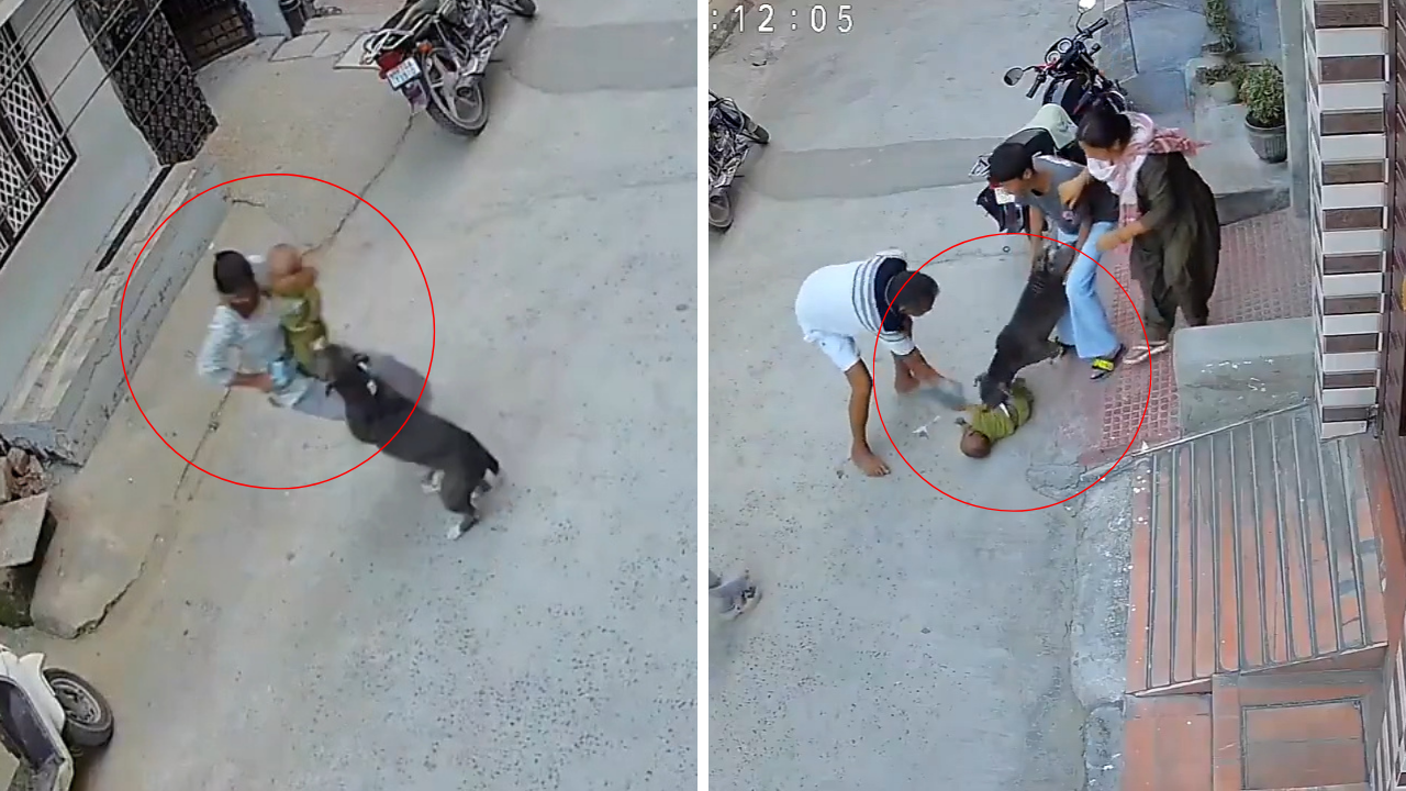 Bu görüntülere yürek dayanmaz! Altı aylık bebeğe pitbull saldırdı
