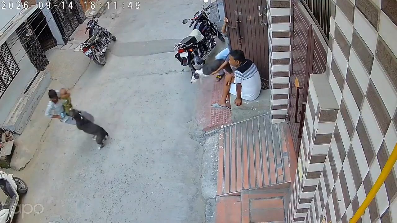 Bu görüntülere yürek dayanmaz! Altı aylık bebeğe pitbull saldırdı
