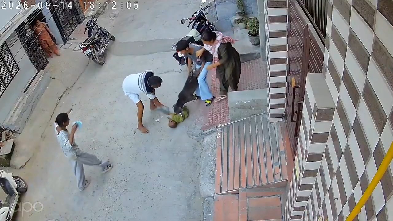 Bu görüntülere yürek dayanmaz! Altı aylık bebeğe pitbull saldırdı