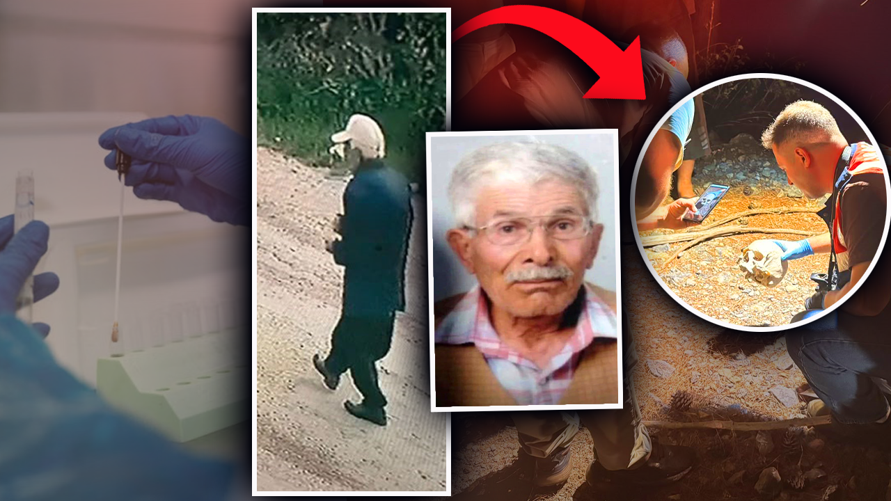 ÖNCE KAFATASI ŞİMDİ TAKMA DİŞ!