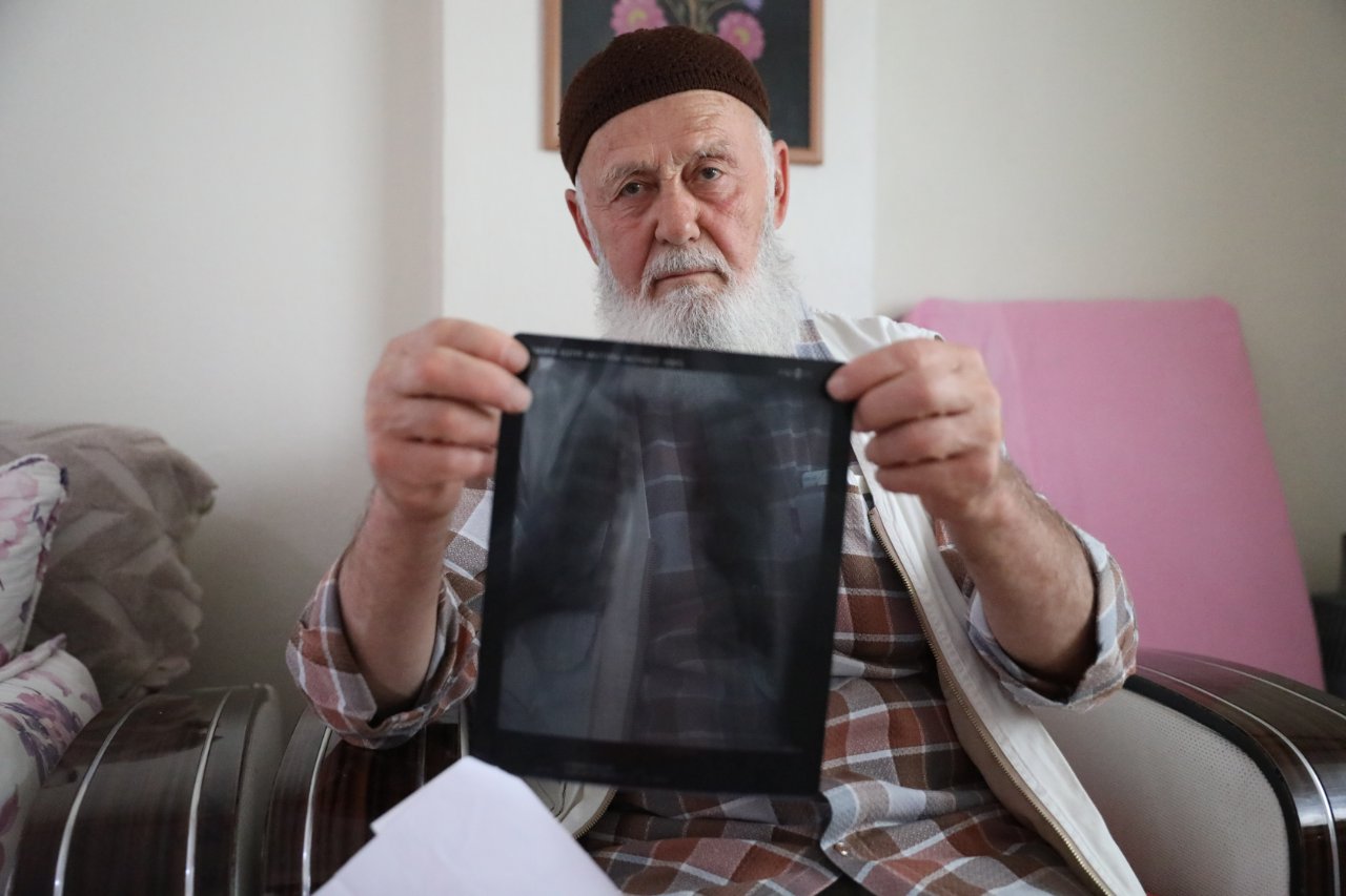 Bedelini yıllar sonra ağır ödedi! 3 parmağını kaybetti, kalbinden ameliyat oldu