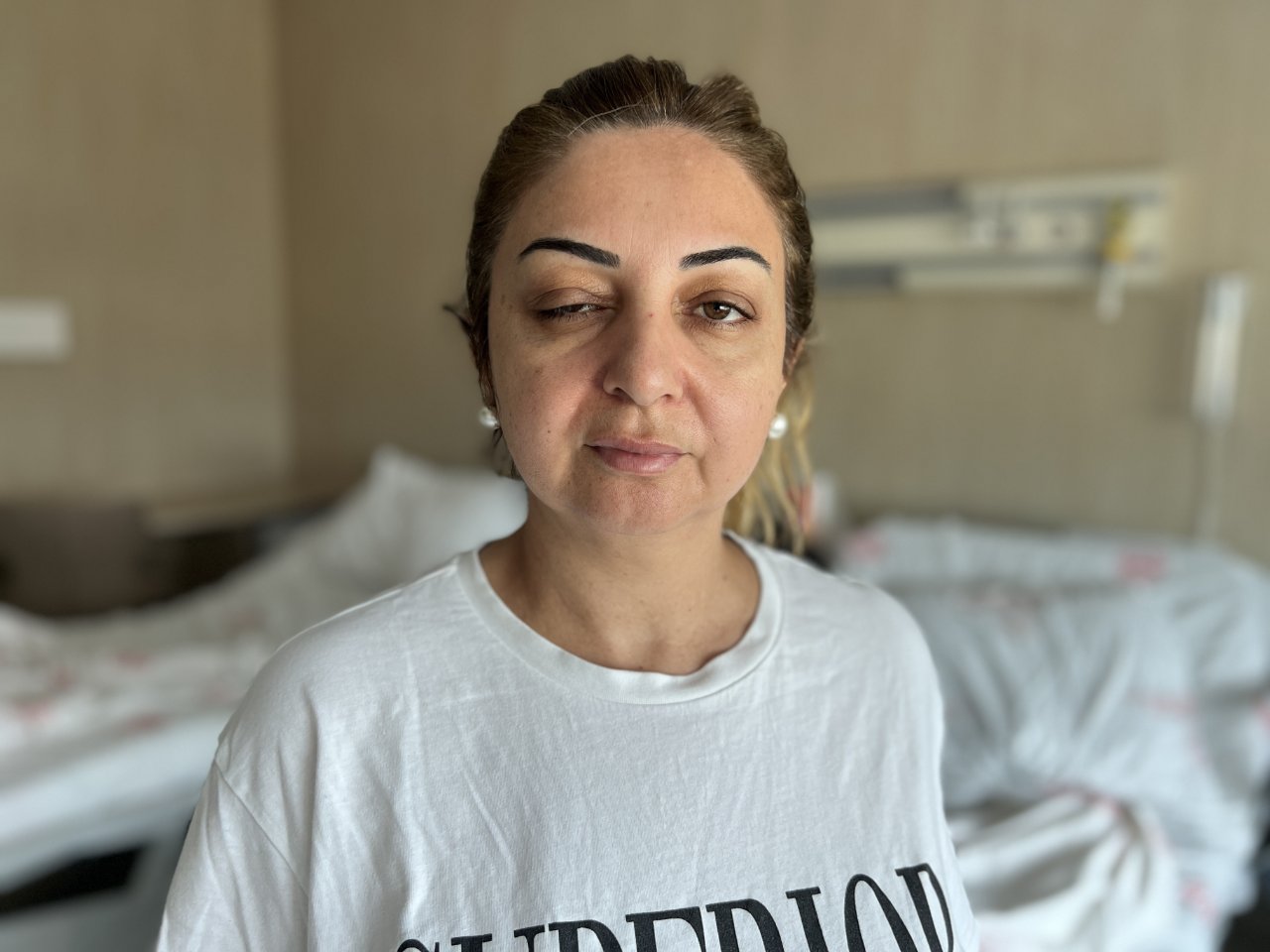 Migrene iyi gelsin diye botoks yaptırdılar! Belirtiler 15 gün sonra çıktı, kabusu yaşadılar