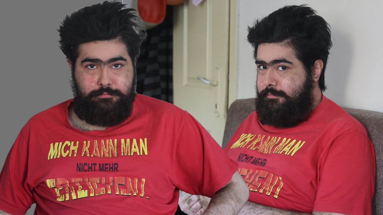 DUŞ ALMIYOR, EVDEN ÇIKMIYOR
