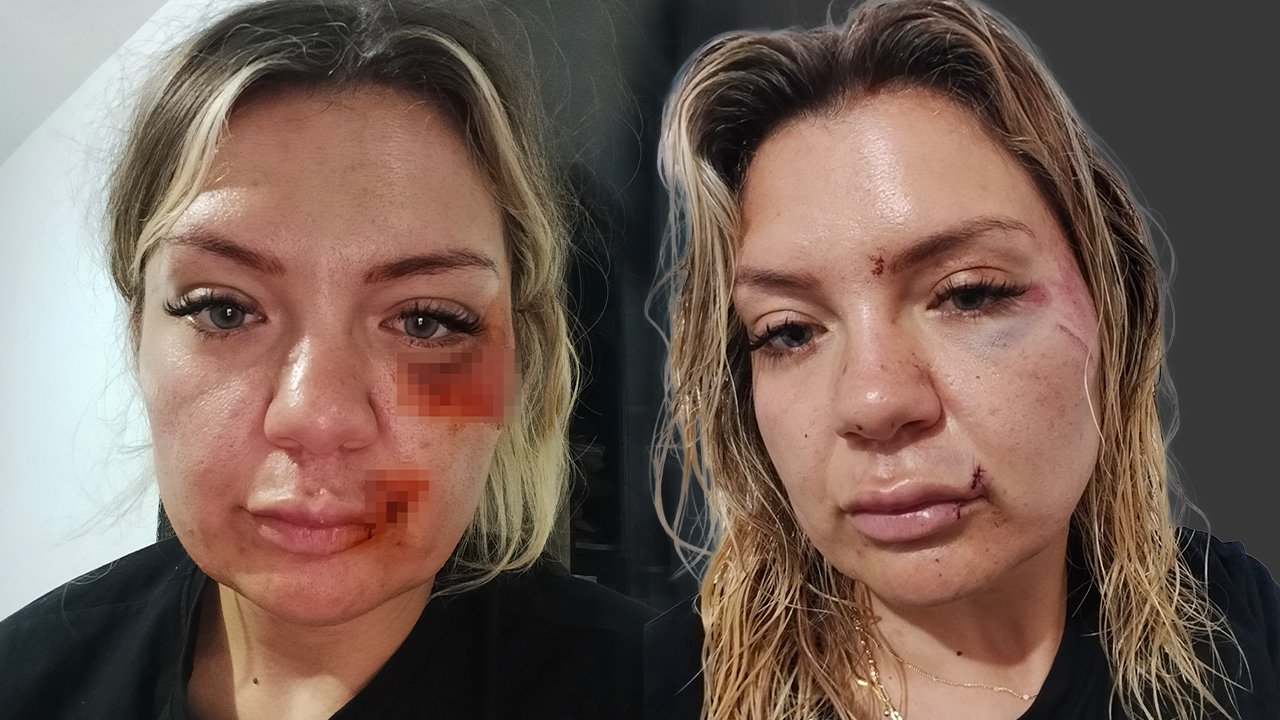 Art arda saldırdı, sırtına bıçak kırdı! 