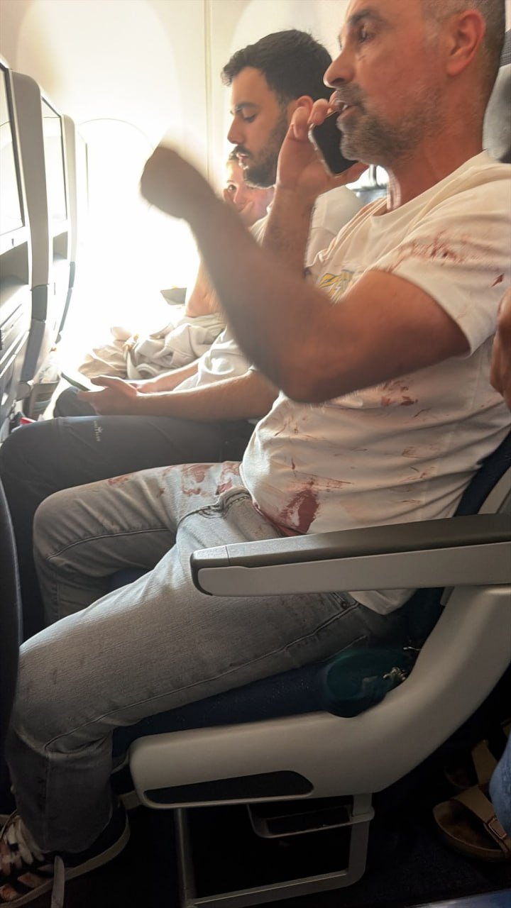 Dünyanın nefesini tutarak izlediği uçakta kanlı kavga! Pilot bıçaklandı, ani dalışa geçtiler