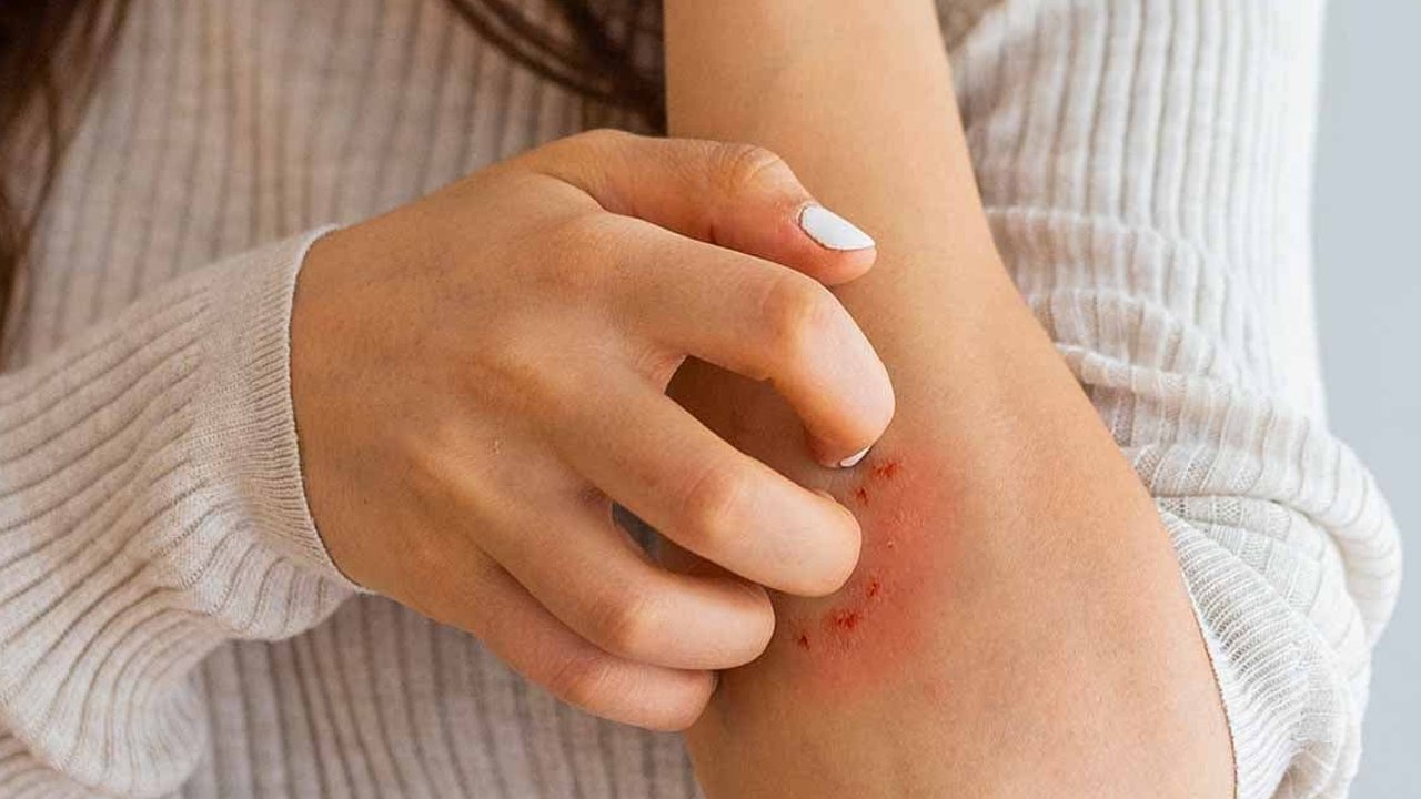 Kaşıntı, pullanma, çatlama… Sonbaharda cildinizi bekleyen tehlikeye dikkat