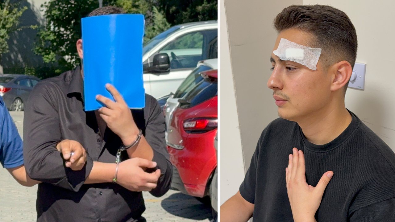 Hastanede röntgen teknisyenine saldırı! Kaşını açıp omzunu kırdı